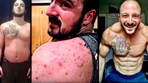 TRT Before and After