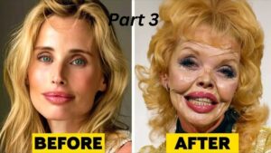 plastic surgery nightmare